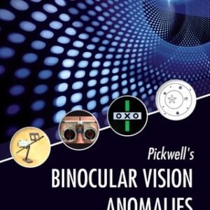 Binocular Vision Anomalies Past Paper Exam